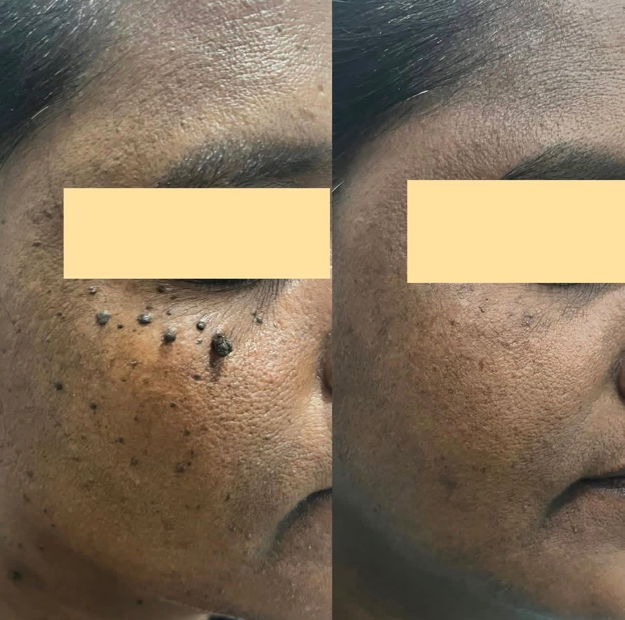 Patient Before and After